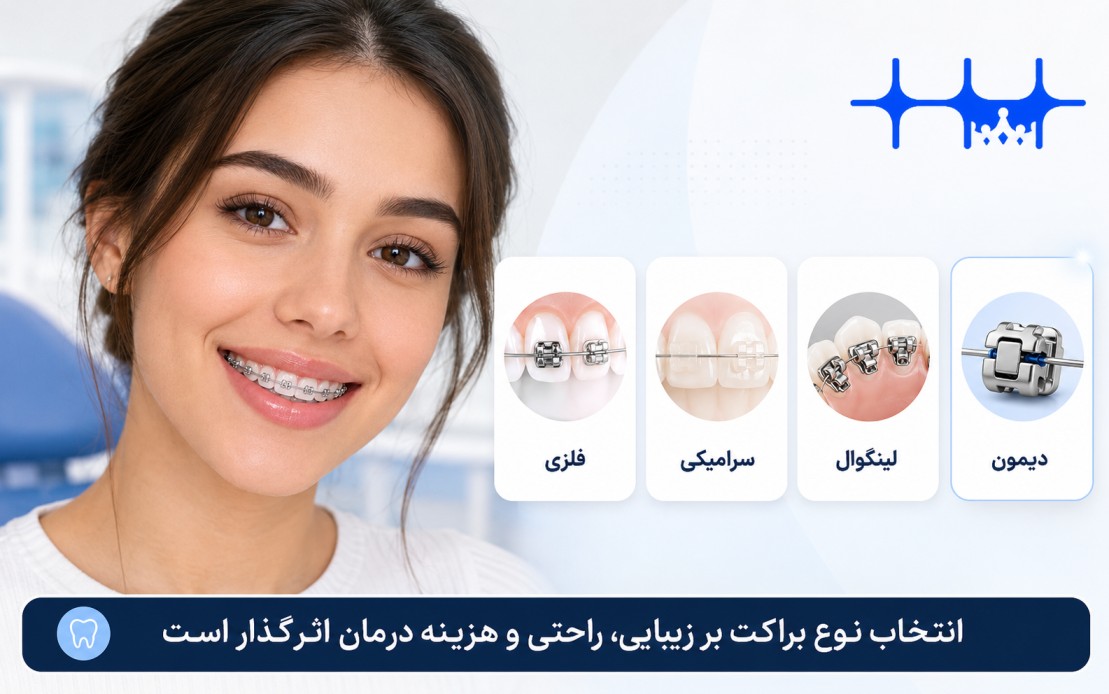 انواع براکت ارتودنسی ثابت