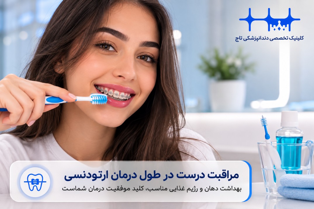 مراقبتهای لازم در طول دوره درمان ارتودنسی ثابت
