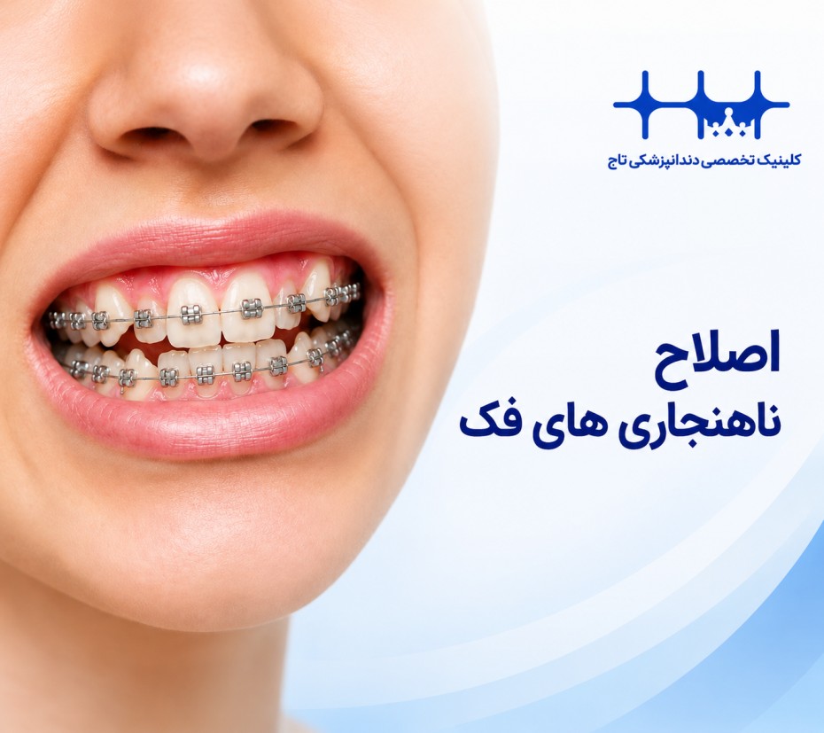 اصلاح ناهنجاری‌های فک: راهنمای جامع درمان با ارتودنسی و جراحی