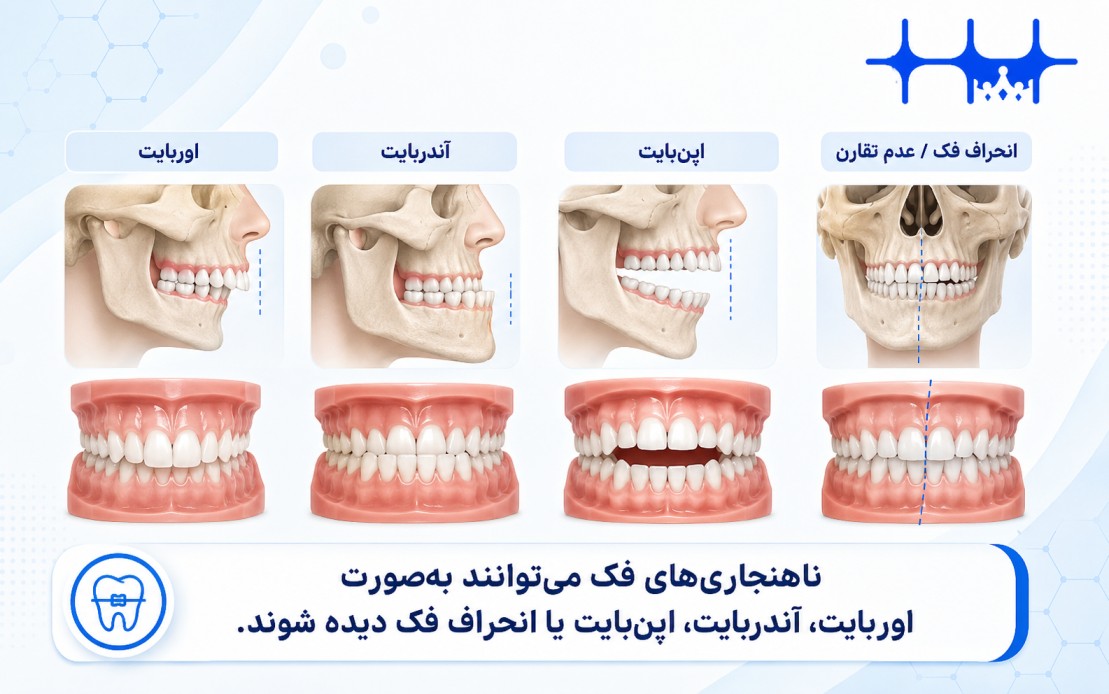 انواع ناهنجاری‌های فک
