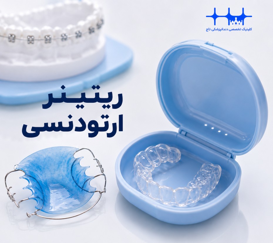 راهنمای جامع ریتینر و نگهدارنده ارتودنسی: حفظ لبخند زیبا پس از درمان