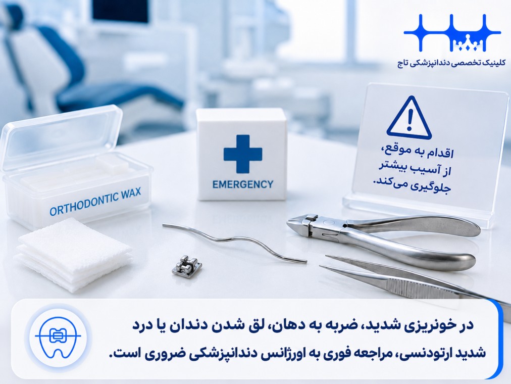 زمان مراجعه به اورژانش ارتودنسی