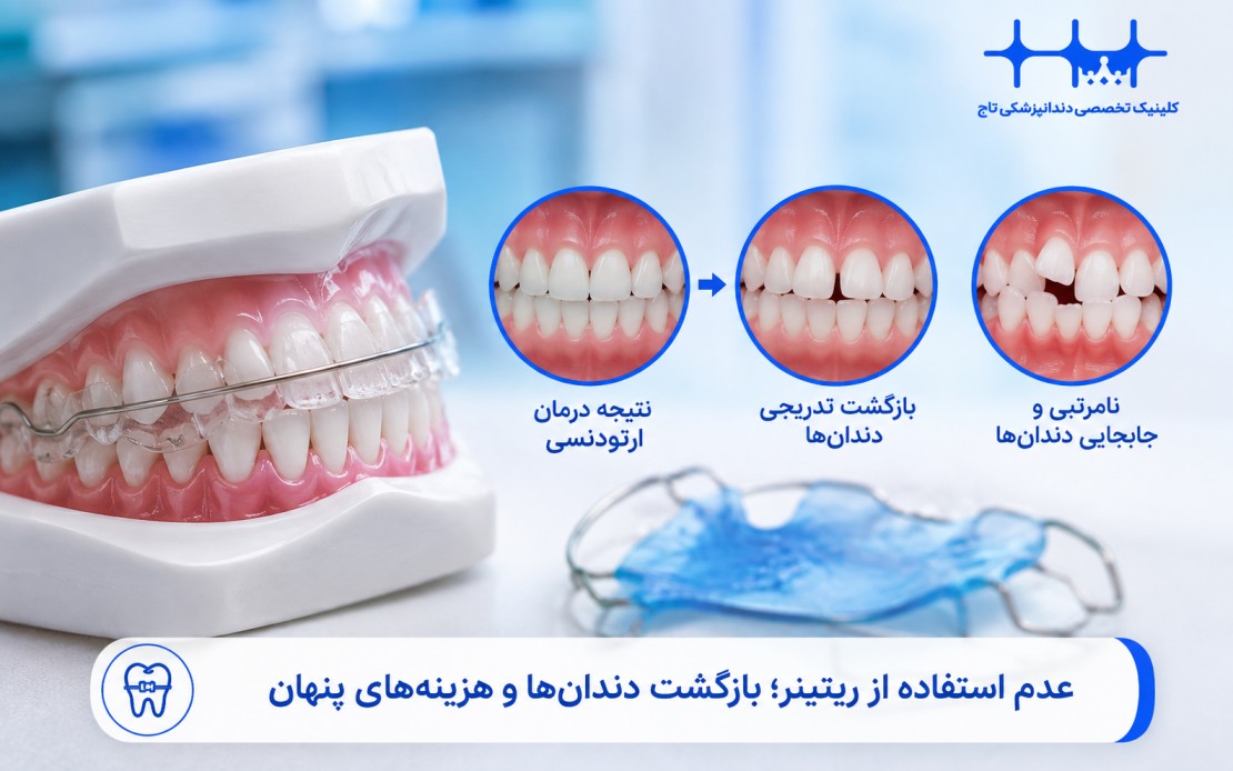 عوارض عدم استفاده از ریتینر