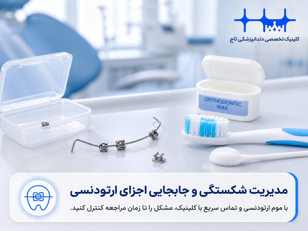 مدیریت شکستگی و جدا شدن اجزای ارتودنسی
