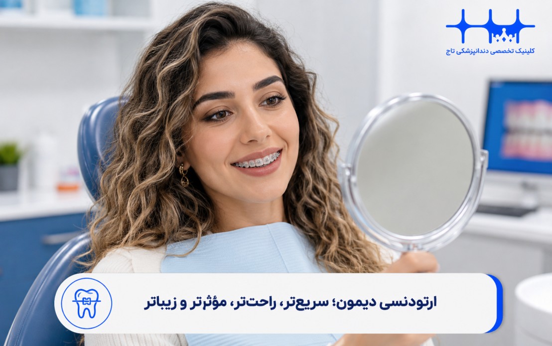 مزایای ارتودنسی دیمون