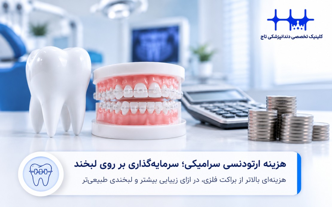 هزینه ارتودنسی سرامیکی